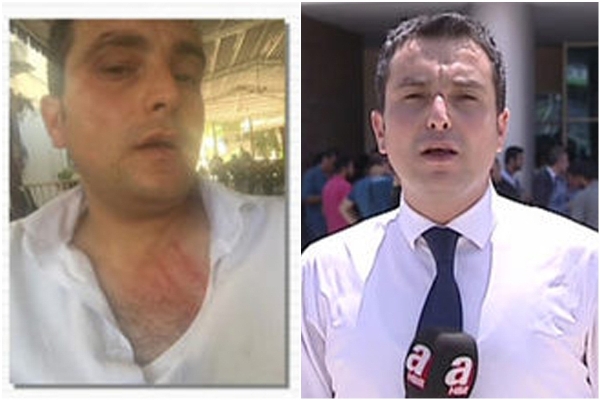 Suruçta gazeteciler saldırıya uğradı