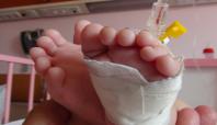 Kızıltepe'de 24 parmaklı 4 aylık bebek