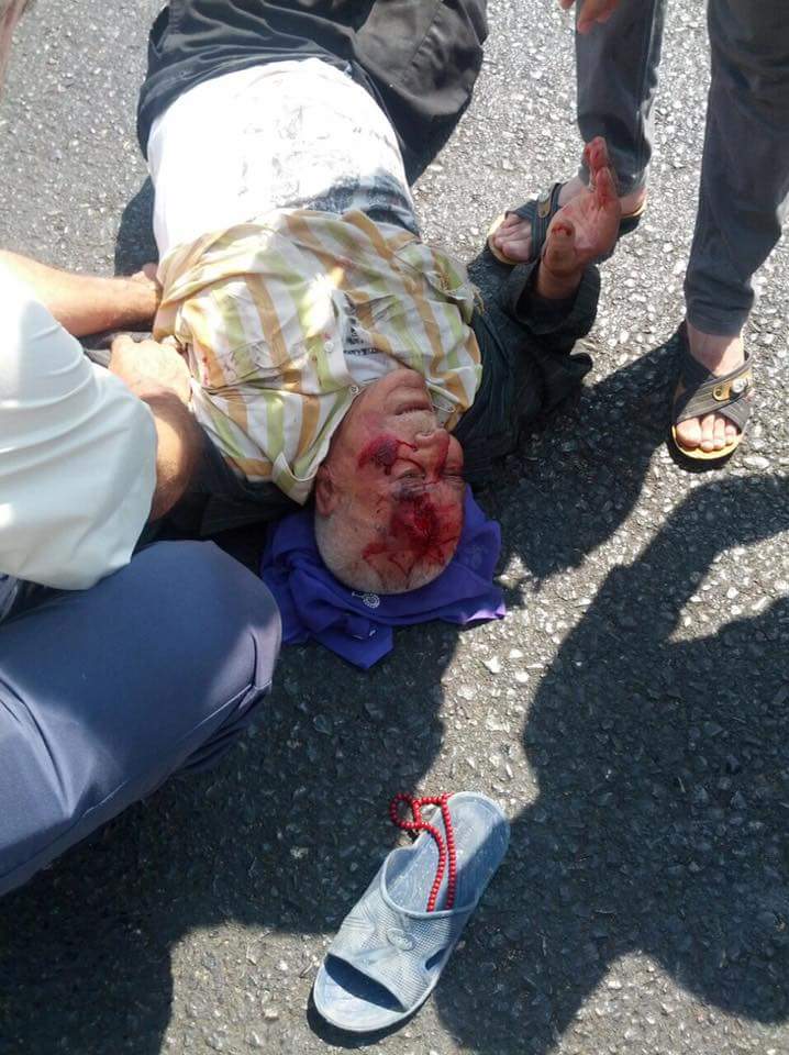 Şanlıurfa'da trafik kazasında ambulans tepkisi