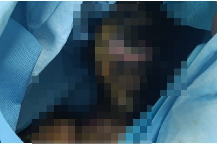 Şanlıurfa’da Yangın Faciası: 7 Yaşındaki Poyraz Efe’den Acı Haber