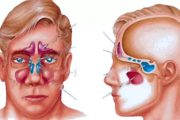 Eczaneyi Unutun, Saniyeler İçinde Burnunuzu Açan Mucize: Sadece Mırıldanın!